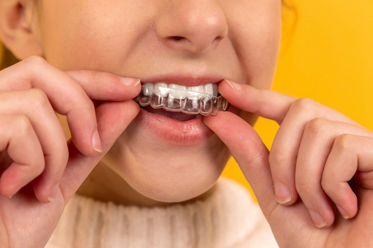 Orthodontic care — representative dental photograph