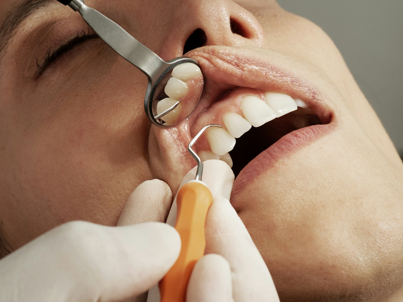 A focus on your smile — representative dental photograph